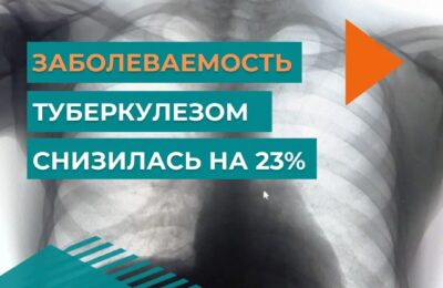 В Новосибирской области на 23% снизилась заболеваемость туберкулезом