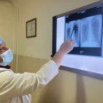 В Новосибирской области выявлено 294 случая патологии ВИЧ+туберкулёз