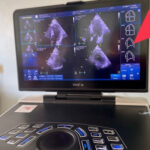 Городская клиническая больница №1 получила новое оборудование по нацпроекту