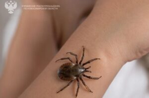82 человека по поводу укусов клещей обратились в больницы региона
